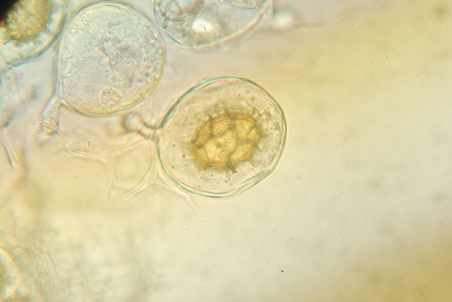 Tuber aestivum